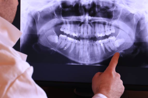 Best Affordable Emergency Dental Care  in Lanse, MI